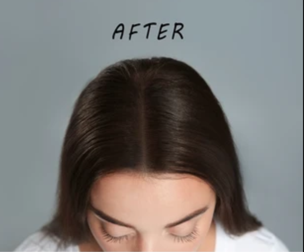 After hair loss